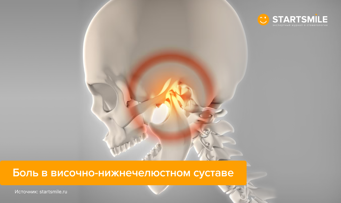 Иллюстрация боли в височно-нижнечелюстном суставе. 