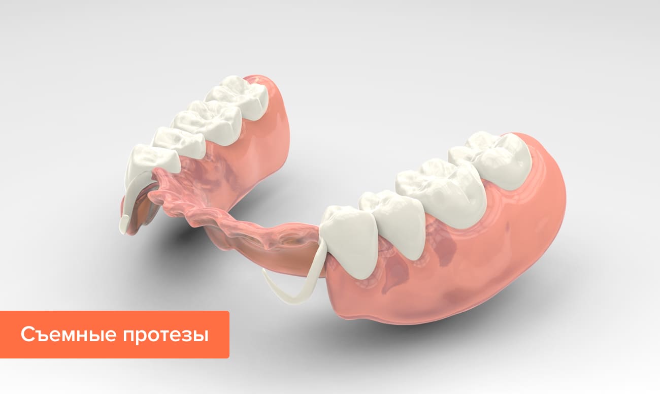 Фото съемных протезов