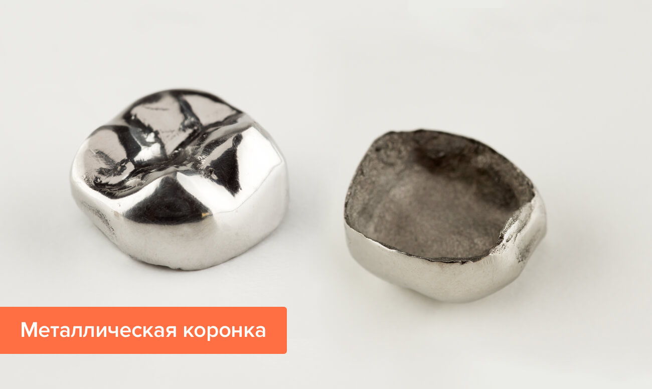 Металлические коронки противопоказания к применению thumbnail