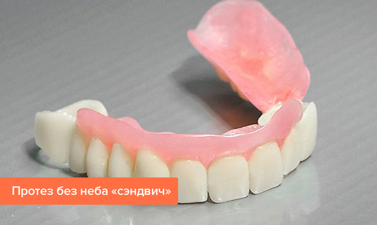 Зубные Протезы Цена И Фото Недорогие