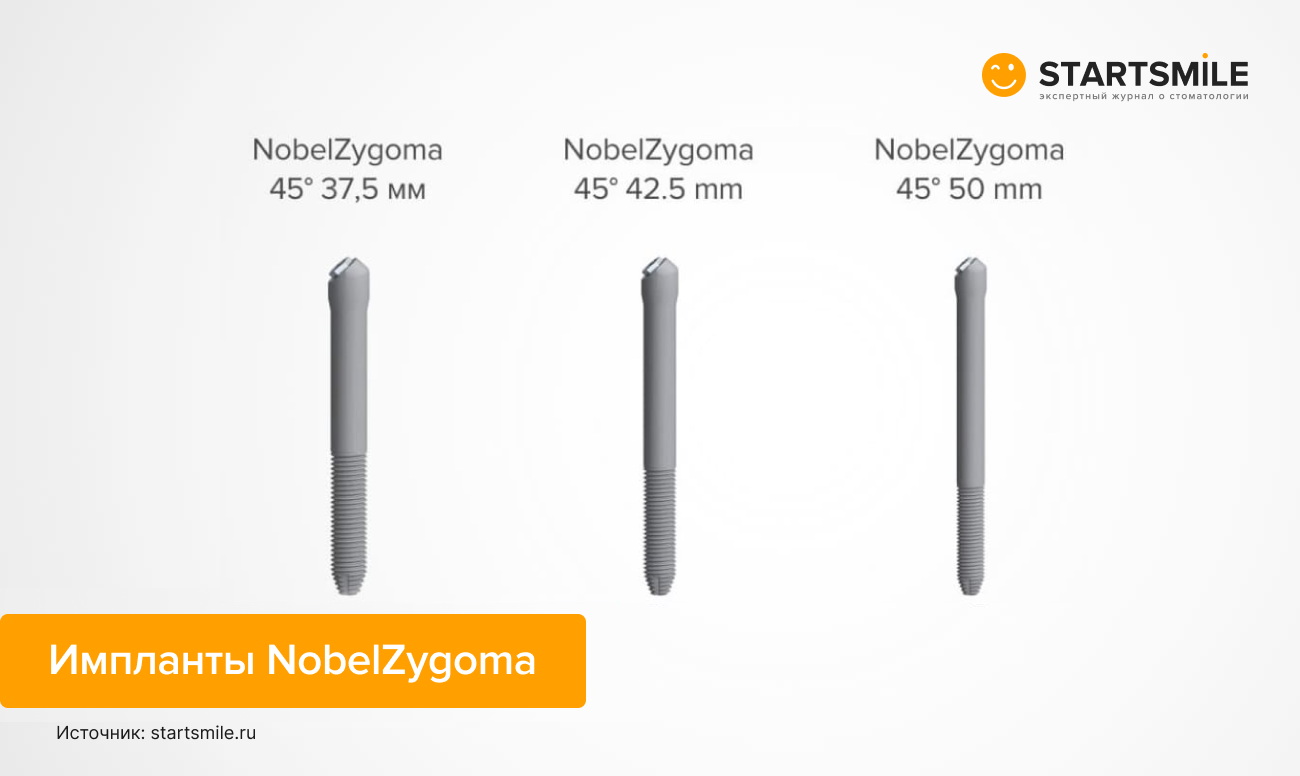 Фото имплантов NobelZygoma