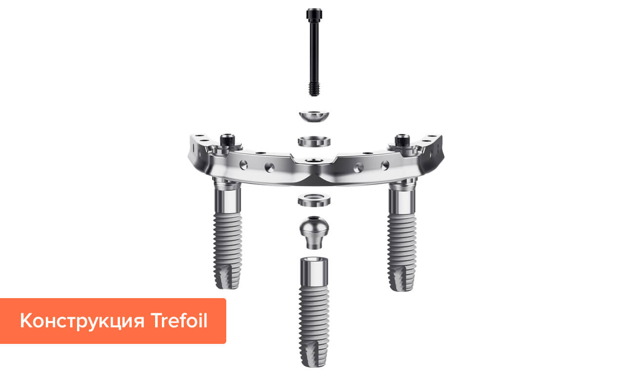 Конструкция Trefoil Фото конструкции Trefoil