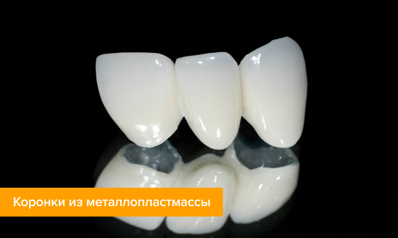 Фото зубных коронок из металлопластмассы