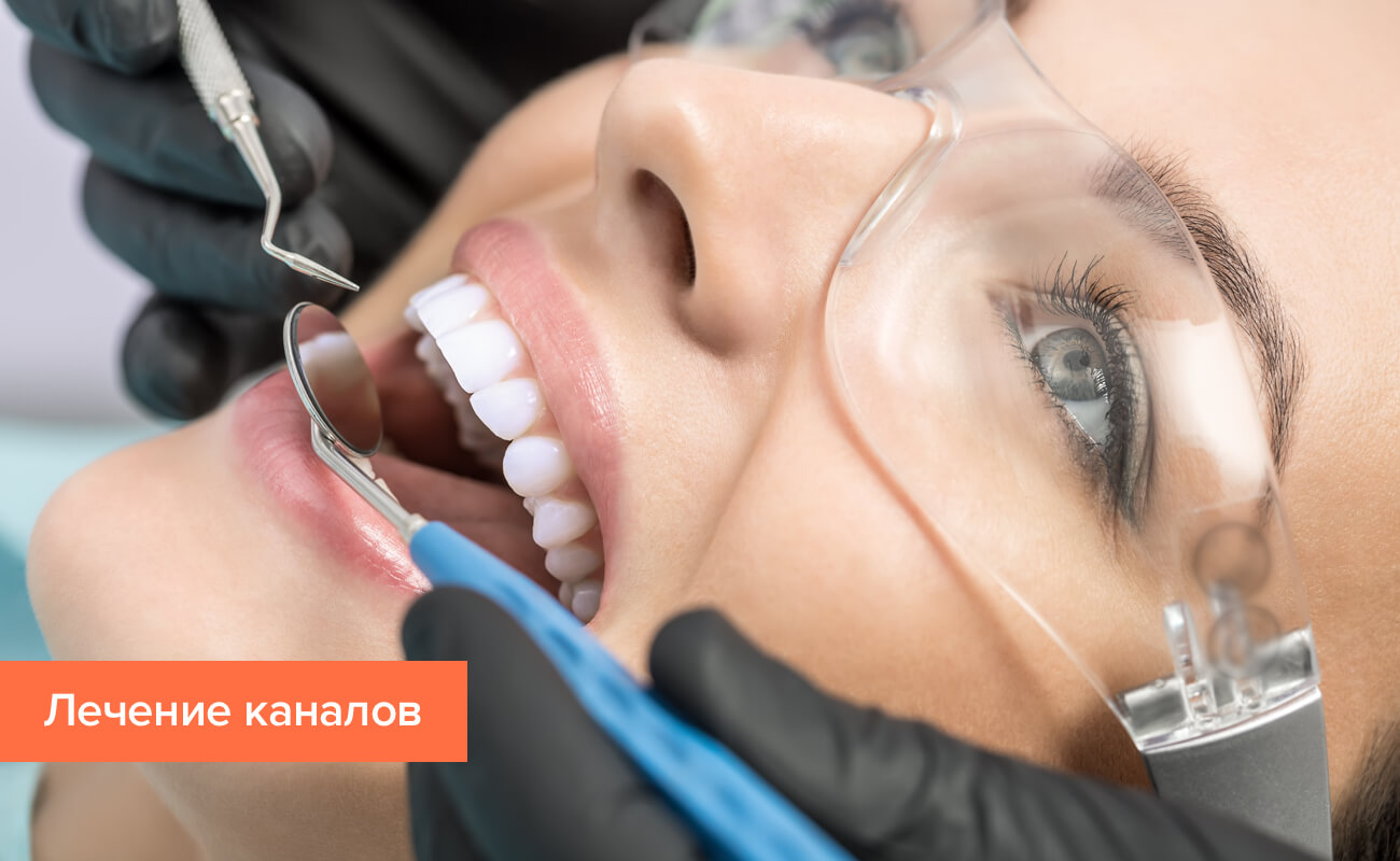 Фото процесса лечения каналов зуба