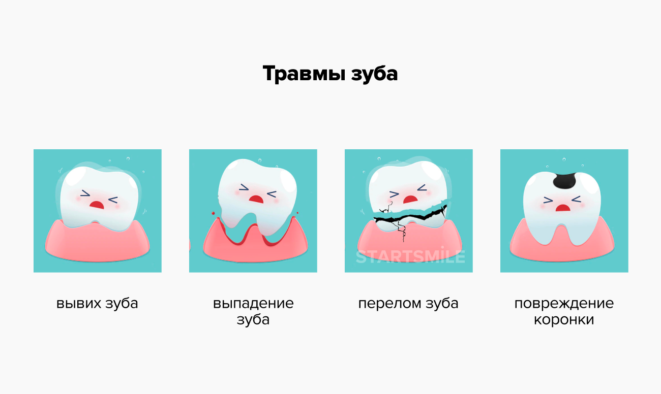 Травмы зуба Различные травмы зуба в картинках