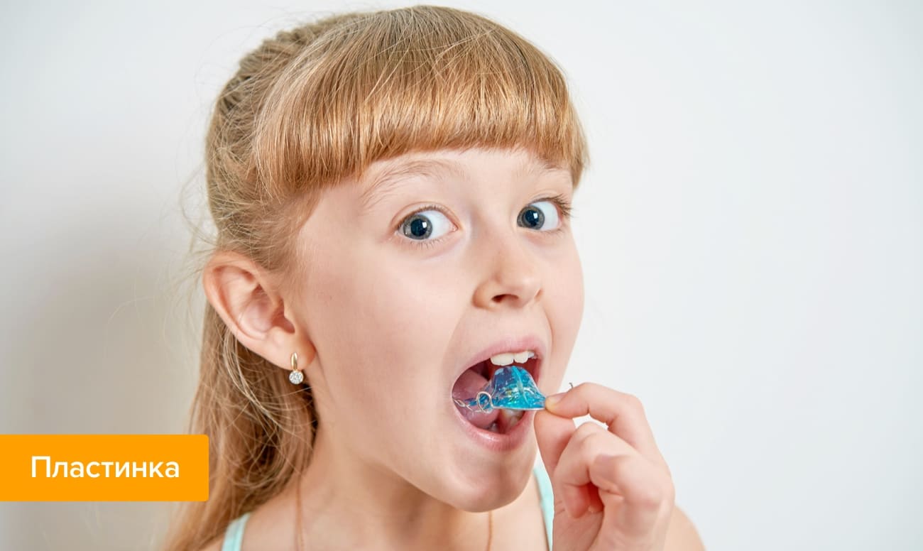 Фото пластинки для выравнивания детских зубов