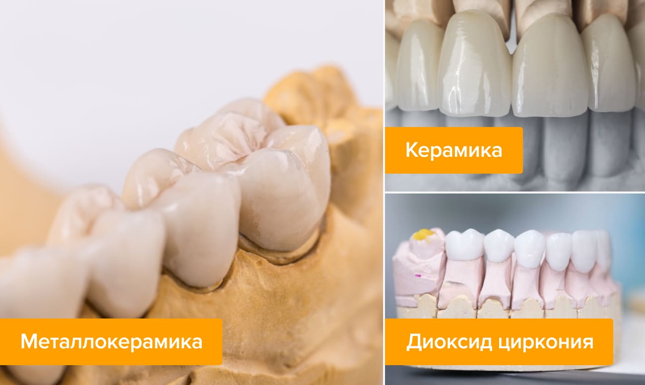 Фото материалов для зубных протезов