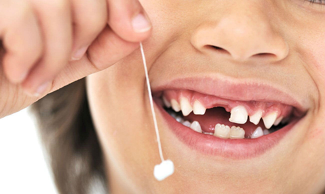 Удаление молочного зуба Томск Краснодонская закон о защите прав потребителей в стоматологии