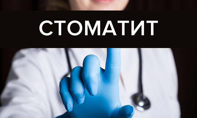 Лечение стоматита у взрослых: виды, препараты