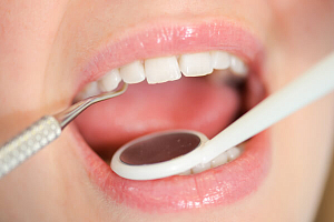 В Севастополе стоматологи не замечают рак полости рта