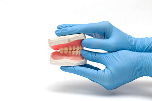 Какие лучшие зубные протезы?