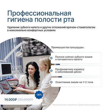 30% на профессиональную гигиену полости рта