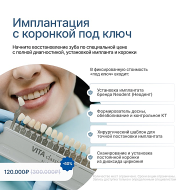 Имплантация с коронкой «ПОД КЛЮЧ»