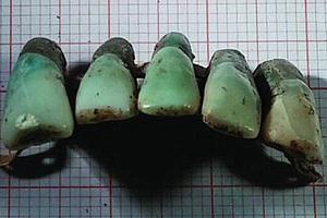 Древние зубные протезы
