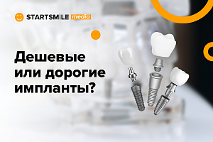 Зубные импланты: выбираем лучшие!