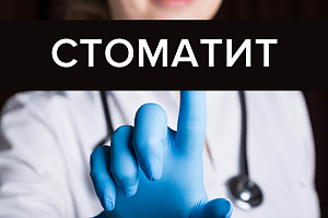 Лечение стоматита у взрослых: виды, препараты