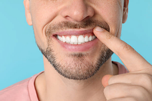 Вставить зубы – какие лучше?