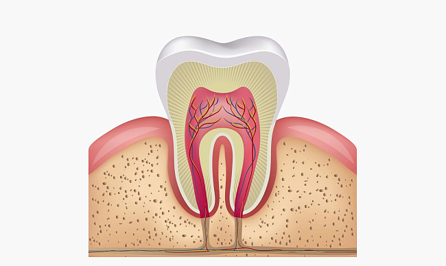 Как убить нерв в зубе?