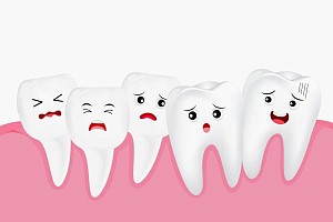 Смещение зубов: причины и способы лечения