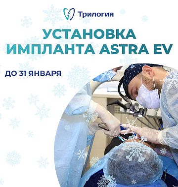 Установка импланта Astra EV + работа хирурга за 63 600 руб.