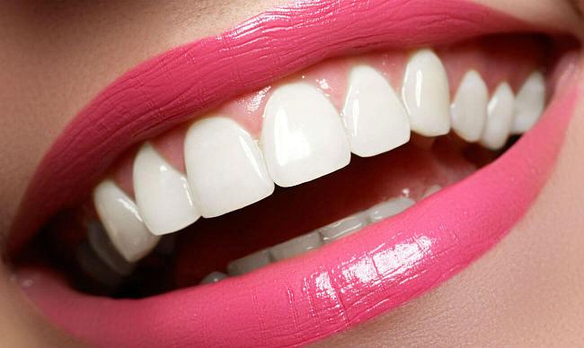 Что такое окклюзия зубов