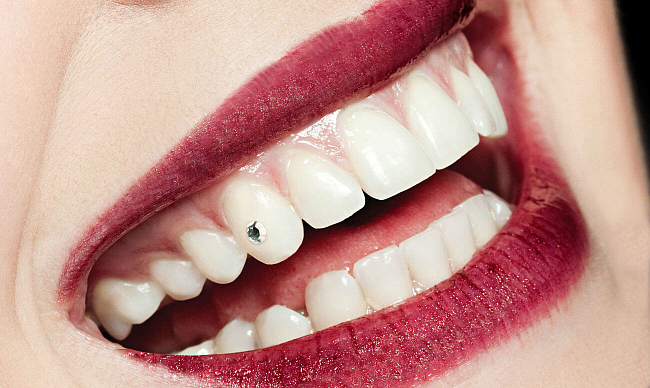 Скайсы на зубы Томск Степная 2-я томск детская стоматология ленина