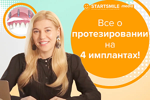 Имплантация зубов All-on-4