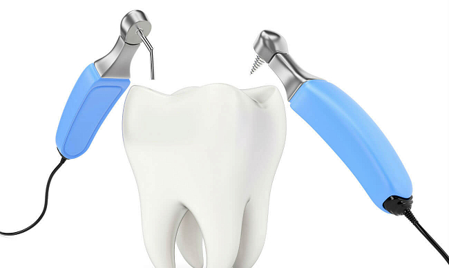 Реплантация зуба
