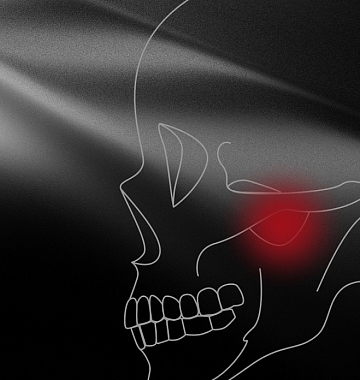 30% скидка на ортодонтическую диагностику