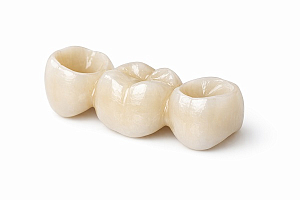 Мостовидные протезы