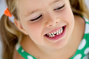 Кривые зубы у ребенка
