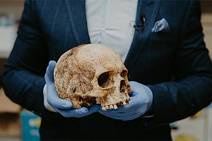 Найден череп с протезом неба
