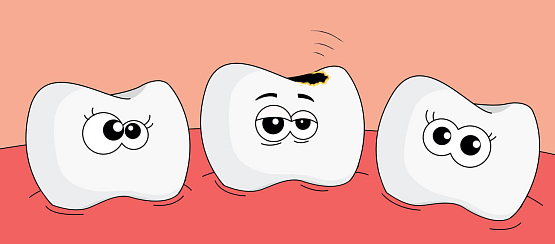 Лечение зубов у детей