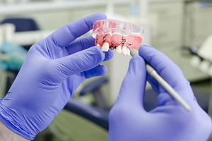 Как делают имплантацию зубов?