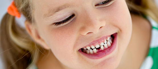 Кривые зубы у ребенка