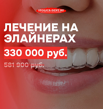 Идеально ровные зубы незаметно для окружающих!