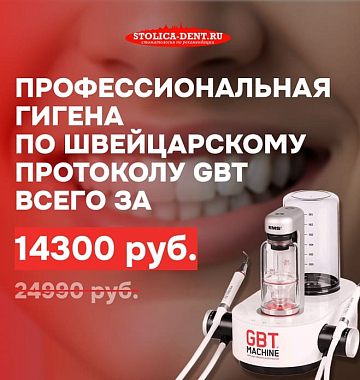 14300 рублей за стерильную чистоту зубов.