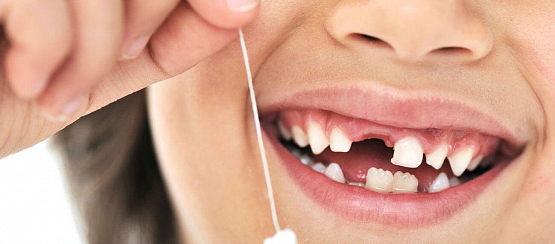 Удаление молочных зубов