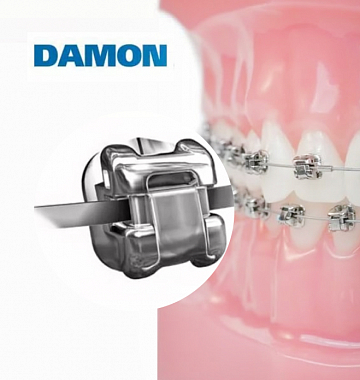 Металические брекеты Damon Q (Ormco) за 235 000 рублей