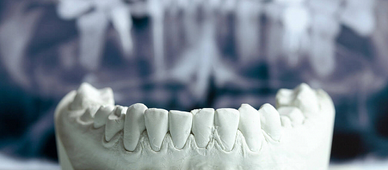 Зачем нужно восстановление кости?