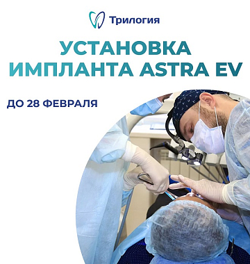 Установка импланта Astra EV + работа хирурга за 63 600 руб.