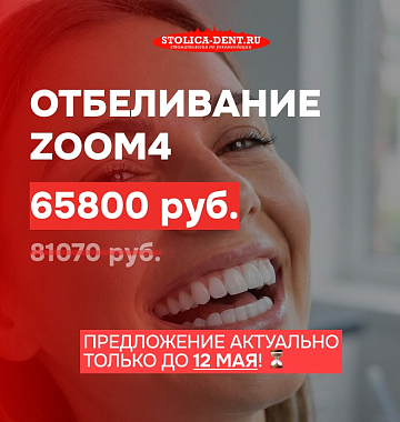 Профессиональное отбеливание зубов по системе Zoom 4 за 65 800 ₽ вместо 81 070 ₽.