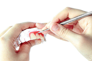 Коррекция зубов: все современные методики